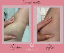 Load image into Gallery viewer, Cellulite & Slimming Gel | 200ml (Refill)