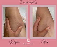 Load image into Gallery viewer, Ultimate Cellulite Starter Kit | 3 products