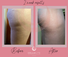 Load image into Gallery viewer, Ultimate Cellulite Starter Kit | 3 products