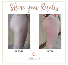 Load image into Gallery viewer, Cellulite Massage Cup | 2 units