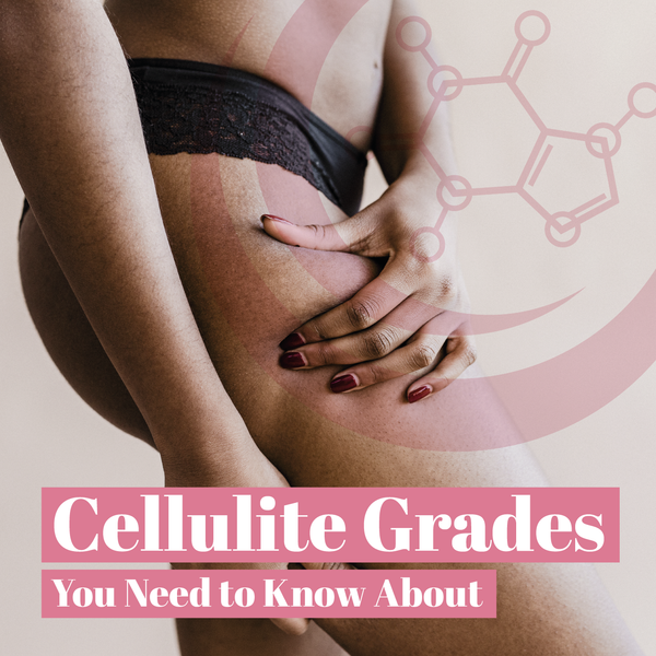 [4] CELLULITE GRADES YOU NEED TO KNOW ABOUT